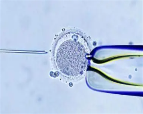 优化二代试管助孕：提高胚胎形成率的策略解析