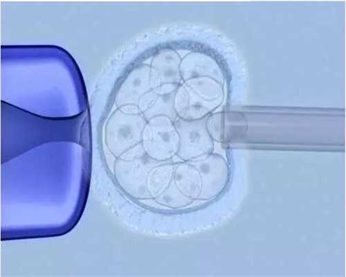 代生报价短方案用150单位进口果纳芬促排一般要打多少天？