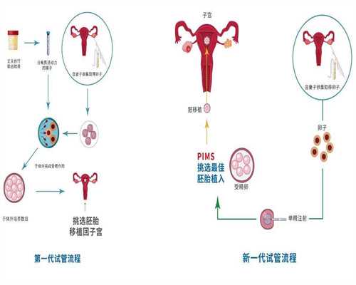 泰国NIC医院第三代助孕：成功率与领先技术全解析